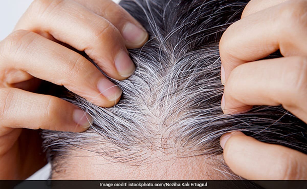 सफेद बालों को जड़ से काला करने में मदद करेंगे ये देसी नुस्खे, फिर कभी नहीं लगानी पड़ेगी मेहंदी और डाई