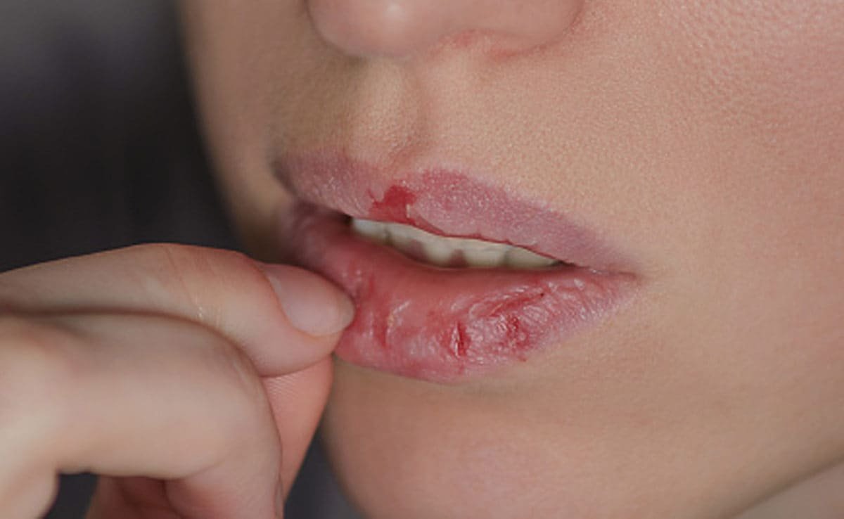 सर्दियों के मौसम में इस तरीके से बनाएं घर पर Lip Balm, रूखे-सूखे होंठ बने रहेंगे मुलायम