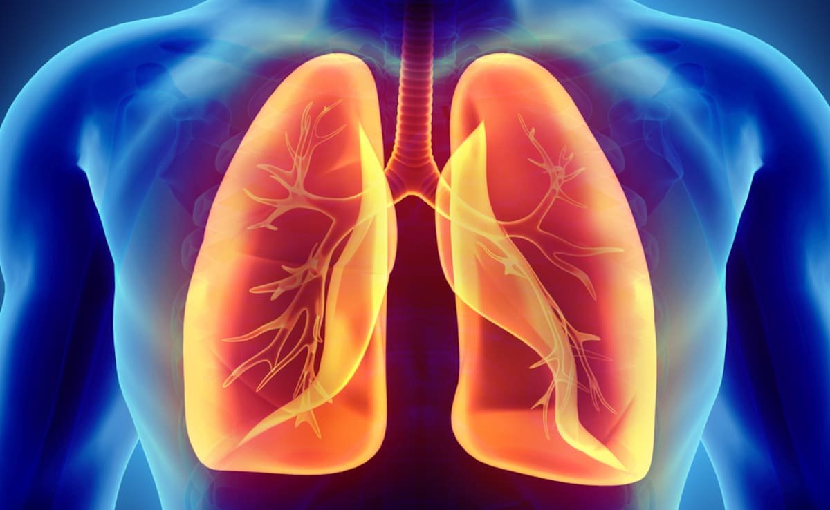Non Smokers में भी बढ़ रहे हैं Lung Cancer के मामले, वजह जानकर डॉक्टर भी हो गए हैरान
