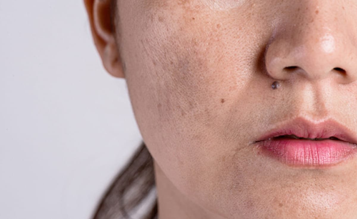 Raw milk for skin care : कच्चे दूध को ऐसे लगाएं फेस पर, सारे दाग-धब्बे पड़ सकते हैं हल्के